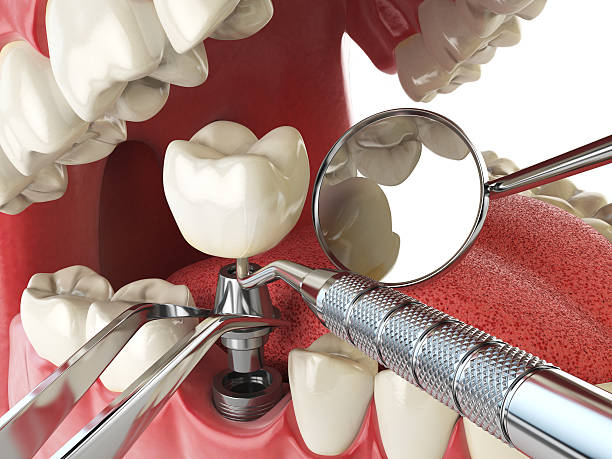 Best Mobile Emergency Dentist in Bellevue, WA